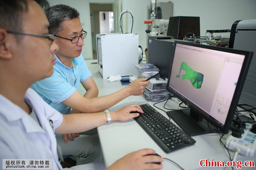 Cirurgia cerebral com tecnologia de impressão 3D é realizada em Shandong