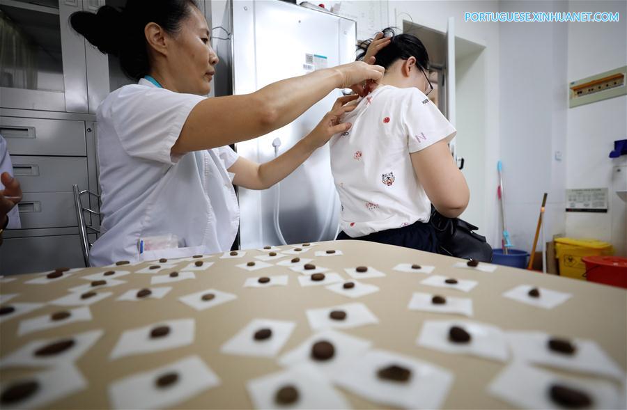 Médicos praticam tratamento de sanfutie para cidadãos na China