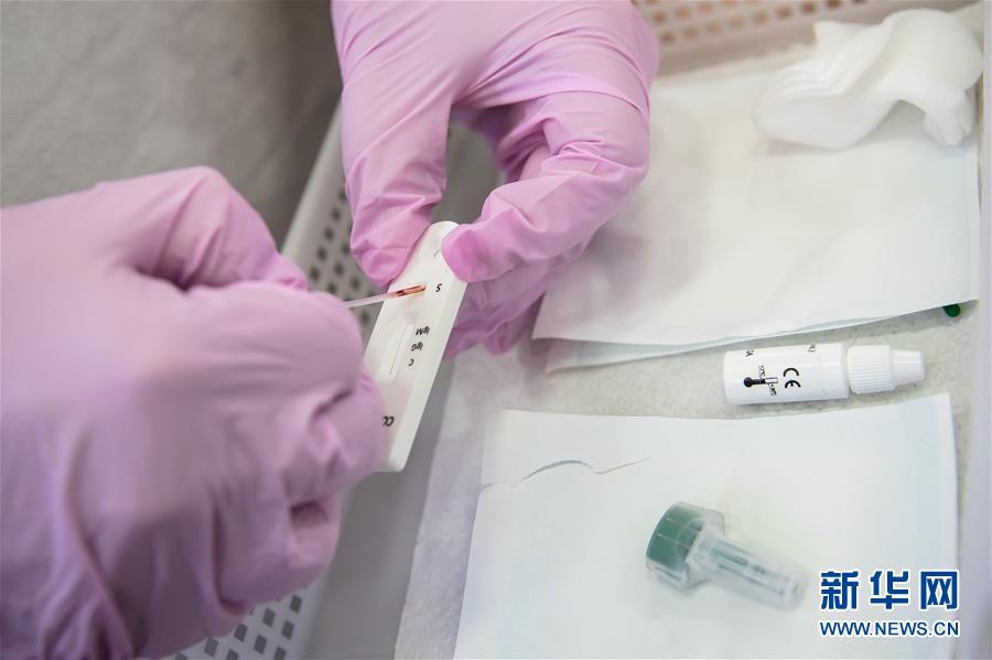 Farmácias francesas fornecem serviços de testes de anticorpos contra Covid-19